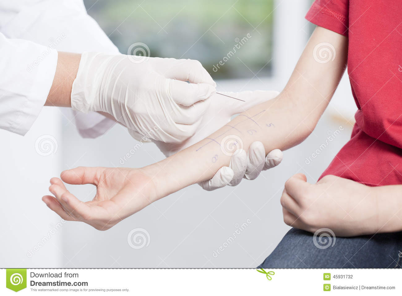 doctor-s-hands-doing-allergy-test-skin-prick-45931732